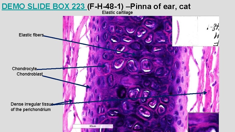 DEMO SLIDE BOX 223 (F-H-48 -1) –Pinna of ear, cat Elastic cartilage Elastic fibers DEMO SLIDE BOX 223 (F-H-48 -1) –Pinna of ear, cat Elastic cartilage Elastic fibers