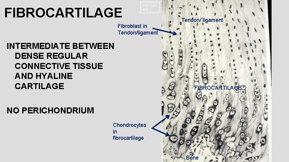 FIBROCARTILAGE Ref code #6 Tendon/ ligament Fibroblast in Tendon/ligament INTERMEDIATE BETWEEN DENSE REGULAR CONNECTIVE FIBROCARTILAGE Ref code #6 Tendon/ ligament Fibroblast in Tendon/ligament INTERMEDIATE BETWEEN DENSE REGULAR CONNECTIVE