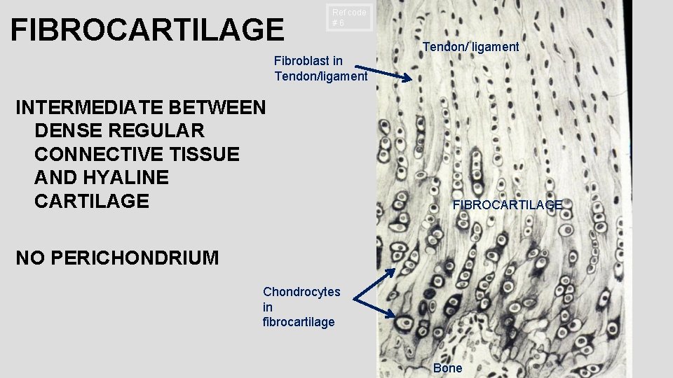 FIBROCARTILAGE Ref code #6 Tendon/ ligament Fibroblast in Tendon/ligament INTERMEDIATE BETWEEN DENSE REGULAR CONNECTIVE