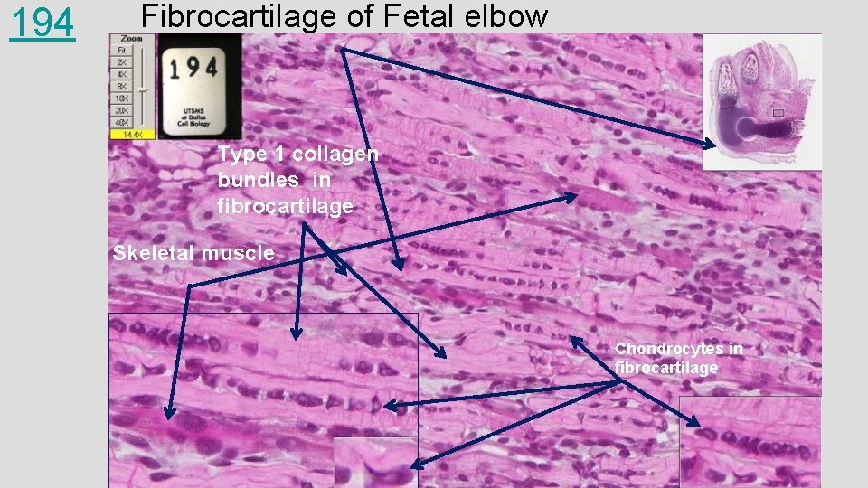 194 Fibrocartilage of Fetal elbow Type 1 collagen bundles in fibrocartilage Skeletal muscle Chondrocytes 194 Fibrocartilage of Fetal elbow Type 1 collagen bundles in fibrocartilage Skeletal muscle Chondrocytes