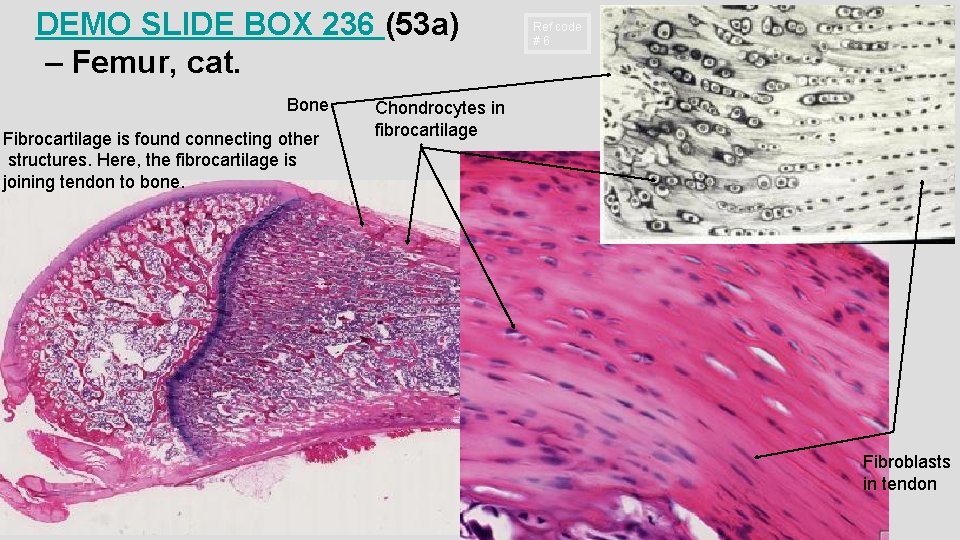 DEMO SLIDE BOX 236 (53 a) – Femur, cat. Bone Fibrocartilage is found connecting
