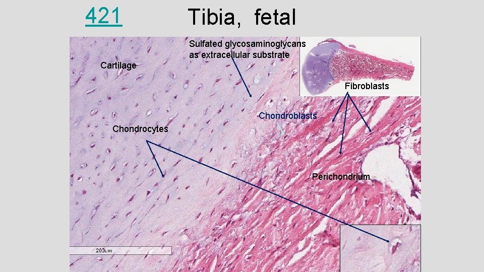 421 Tibia, fetal Sulfated glycosaminoglycans as extracellular substrate Cartilage Fibroblasts Chondrocytes Perichondrium 