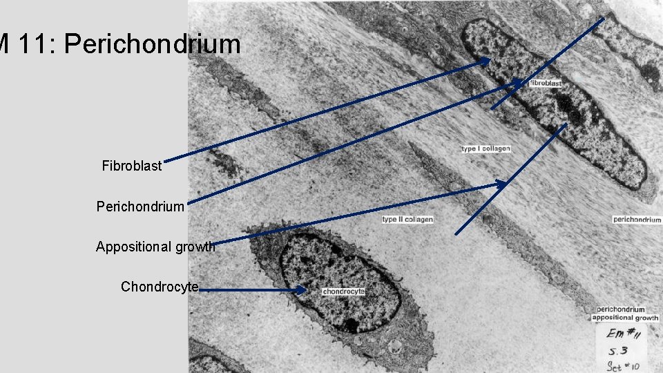 M 11: Perichondrium Fibroblast Perichondrium Appositional growth Chondrocyte 