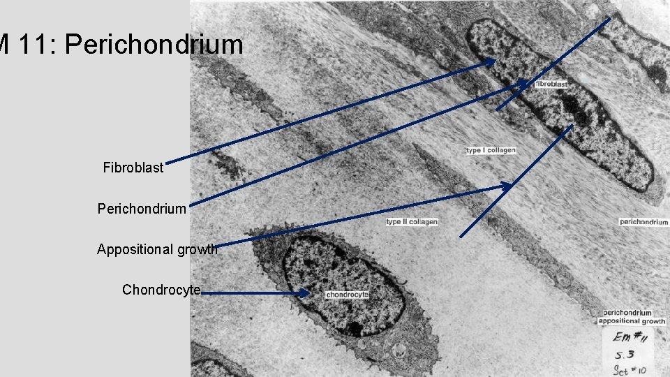 M 11: Perichondrium Fibroblast Perichondrium Appositional growth Chondrocyte M 11: Perichondrium Fibroblast Perichondrium Appositional growth Chondrocyte