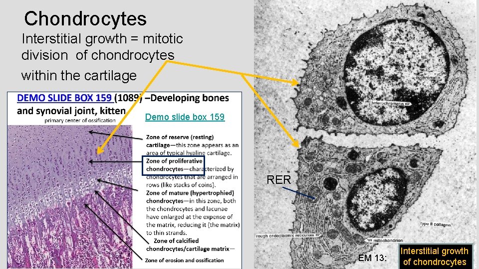 Chondrocytes Interstitial growth = mitotic division of chondrocytes within the cartilage Demo slide box