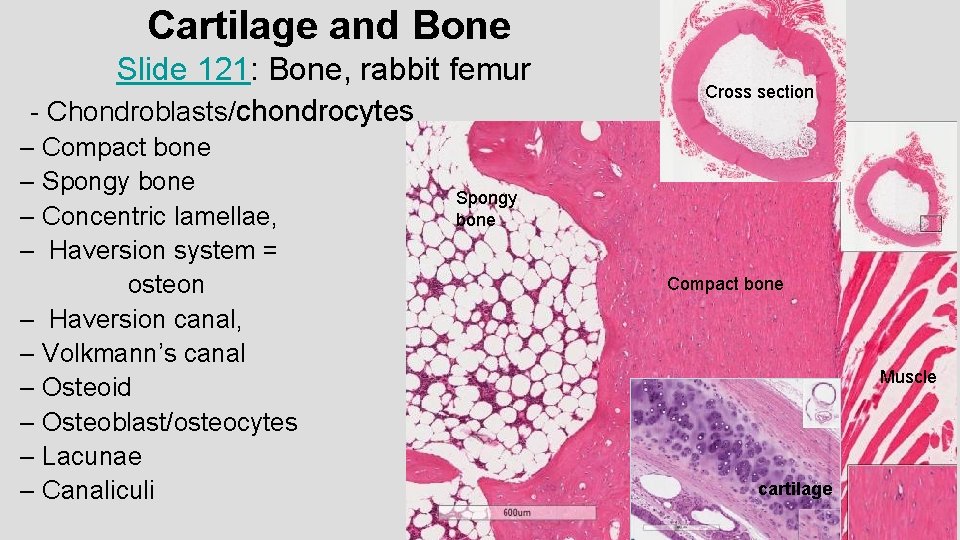 Cartilage and Bone Slide 121: Bone, rabbit femur - Chondroblasts/chondrocytes – Compact bone –