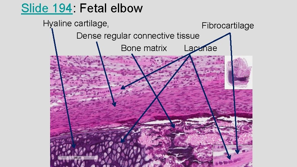 Slide 194: Fetal elbow Hyaline cartilage, Fibrocartilage Dense regular connective tissue Bone matrix Lacunae