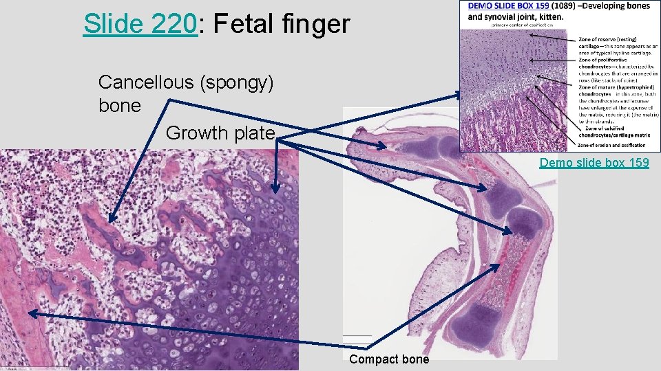 Slide 220: Fetal finger Cancellous (spongy) bone Growth plate Demo slide box 159 Compact