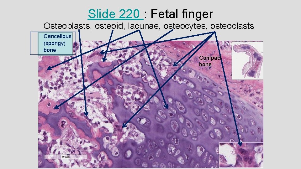 Slide 220 : Fetal finger Osteoblasts, osteoid, lacunae, osteocytes, osteoclasts Cancellous (spongy) bone Compact