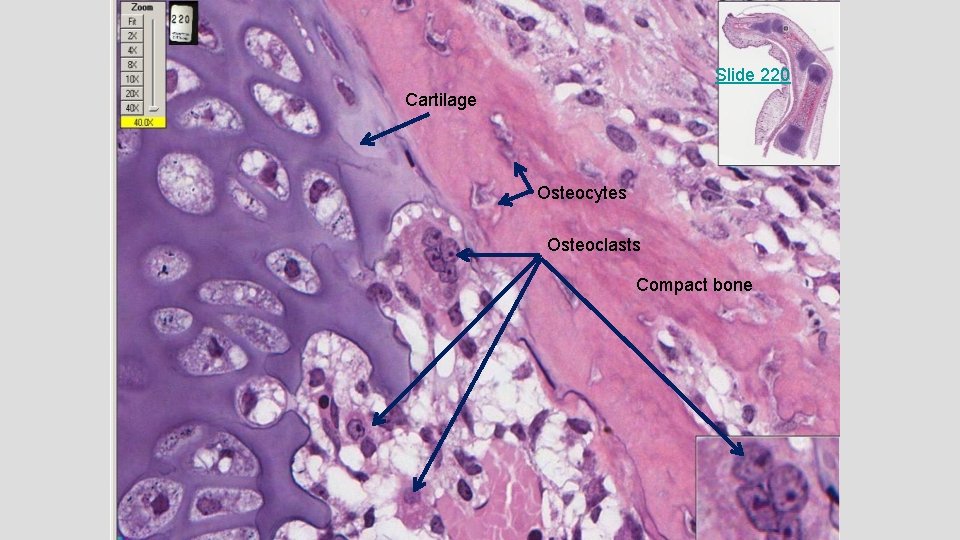 Slide 220 Cartilage Osteocytes Osteoclasts Compact bone Slide 220 Cartilage Osteocytes Osteoclasts Compact bone