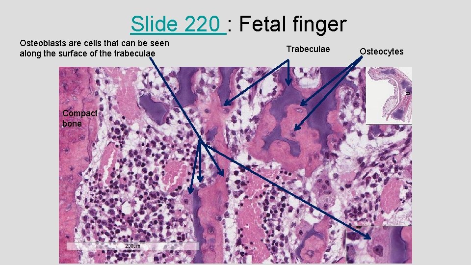 Slide 220 : Fetal finger Osteoblasts are cells that can be seen along the