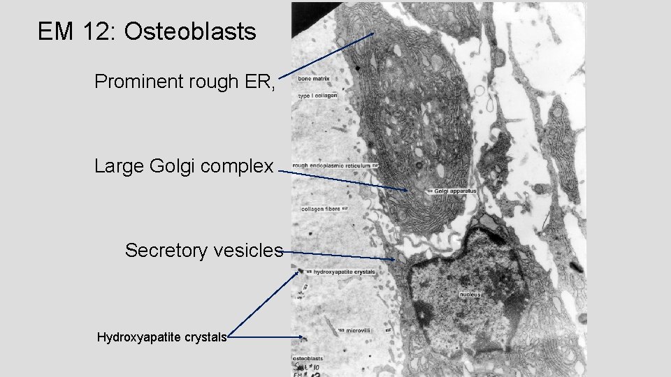 EM 12: Osteoblasts Prominent rough ER, Large Golgi complex Secretory vesicles Hydroxyapatite crystals 