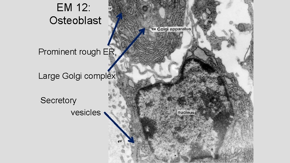 EM 12: Osteoblast Prominent rough ER, Large Golgi complex Secretory vesicles 