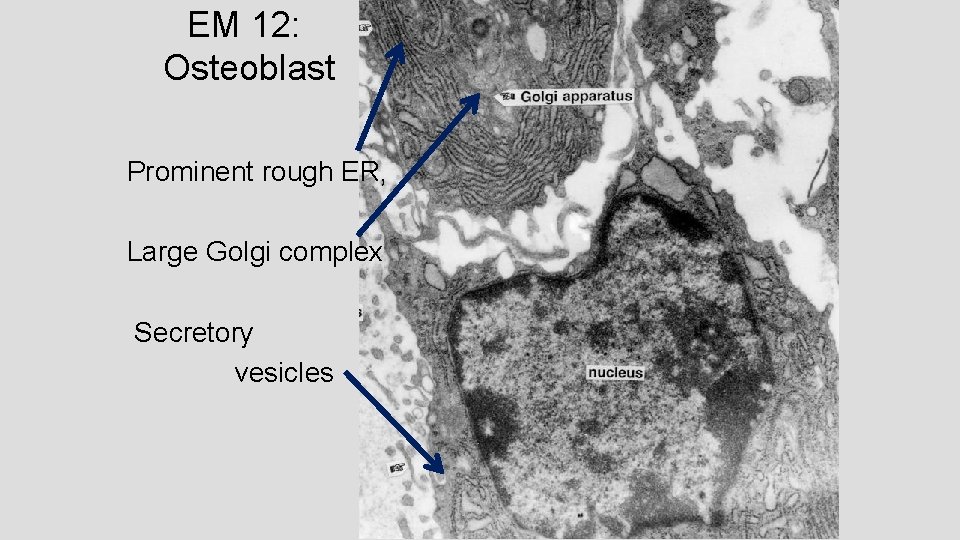 EM 12: Osteoblast Prominent rough ER, Large Golgi complex Secretory vesicles EM 12: Osteoblast Prominent rough ER, Large Golgi complex Secretory vesicles