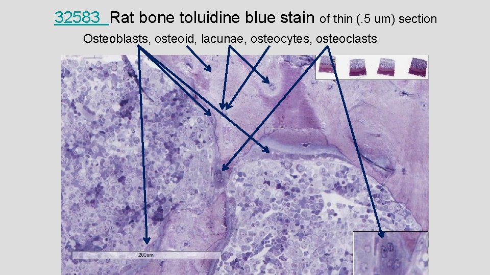 32583 Rat bone toluidine blue stain of thin (. 5 um) section Osteoblasts, osteoid,