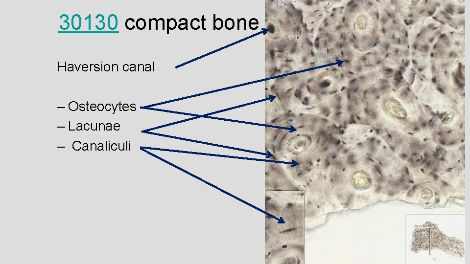 30130 compact bone Haversion canal – Osteocytes – Lacunae – Canaliculi 