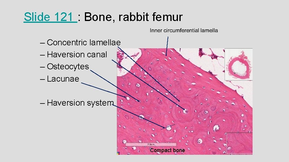 Slide 121 : Bone, rabbit femur – Concentric lamellae – Haversion canal – Osteocytes