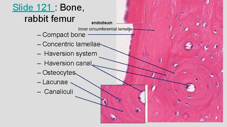 Slide 121 : Bone, rabbit femur endosteum – Compact bone – Concentric lamellae –