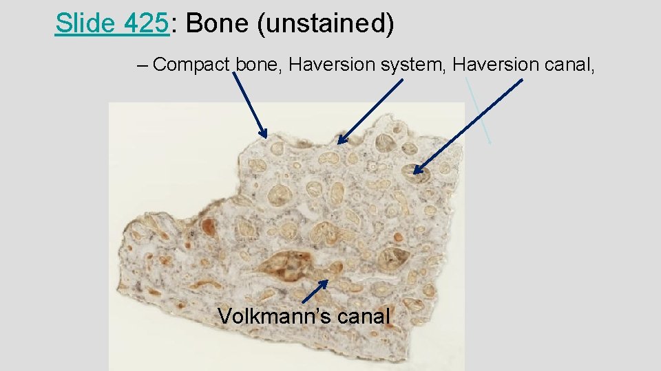 Slide 425: Bone (unstained) – Compact bone, Haversion system, Haversion canal, Volkmann’s canal 