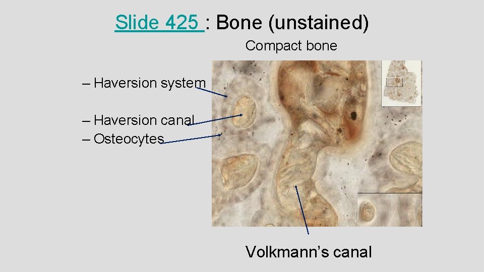 Slide 425 : Bone (unstained) Compact bone – Haversion system – Haversion canal –