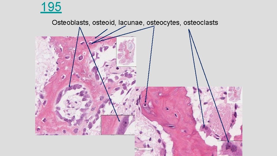 195 Osteoblasts, osteoid, lacunae, osteocytes, osteoclasts 195 Osteoblasts, osteoid, lacunae, osteocytes, osteoclasts