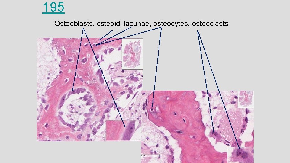 195 Osteoblasts, osteoid, lacunae, osteocytes, osteoclasts 