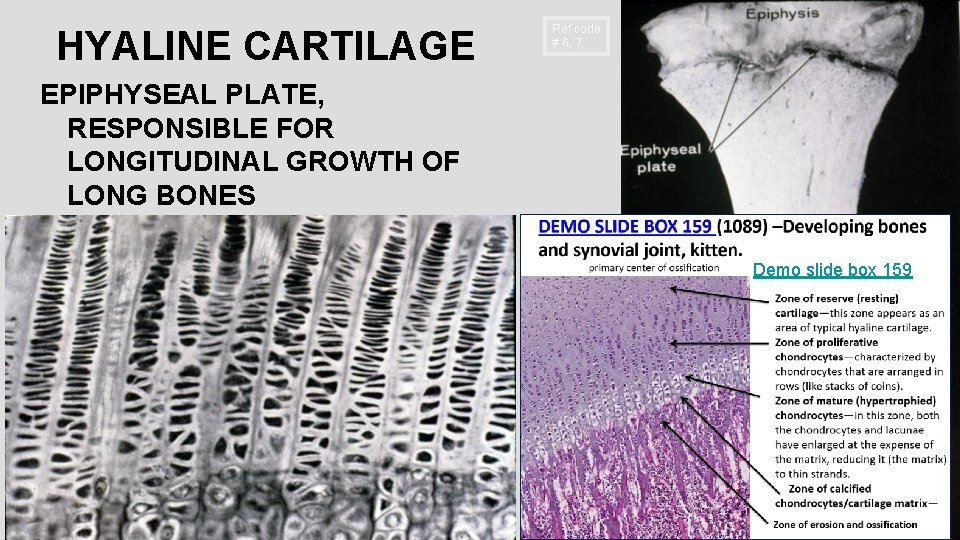 HYALINE CARTILAGE Ref code # 6, 7 EPIPHYSEAL PLATE, RESPONSIBLE FOR LONGITUDINAL GROWTH OF
