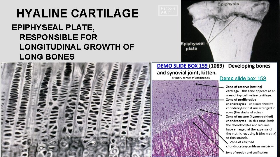 HYALINE CARTILAGE Ref code # 6, 7 EPIPHYSEAL PLATE, RESPONSIBLE FOR LONGITUDINAL GROWTH OF HYALINE CARTILAGE Ref code # 6, 7 EPIPHYSEAL PLATE, RESPONSIBLE FOR LONGITUDINAL GROWTH OF