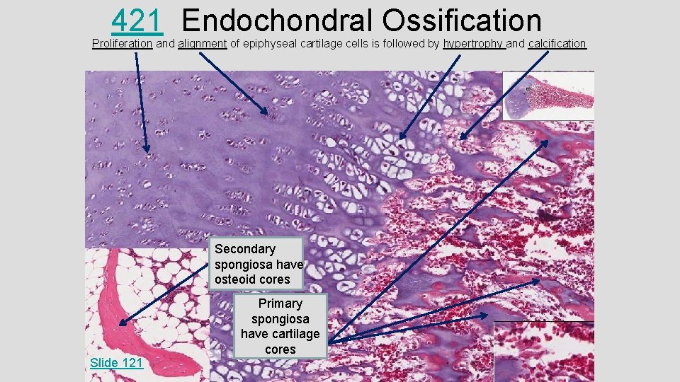 421 Endochondral Ossification Proliferation and alignment of epiphyseal cartilage cells is followed by hypertrophy