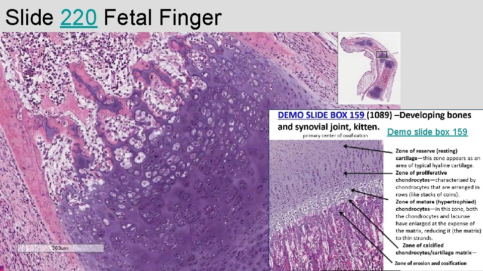 Slide 220 Fetal Finger Demo slide box 159 