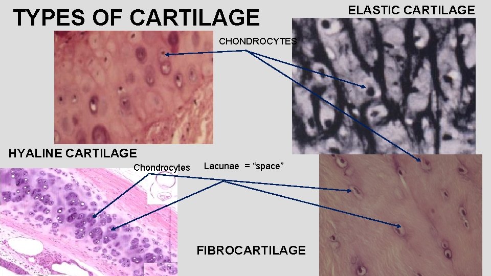 TYPES OF CARTILAGE CHONDROCYTES HYALINE CARTILAGE Chondrocytes Lacunae = “space” FIBROCARTILAGE ELASTIC CARTILAGE 