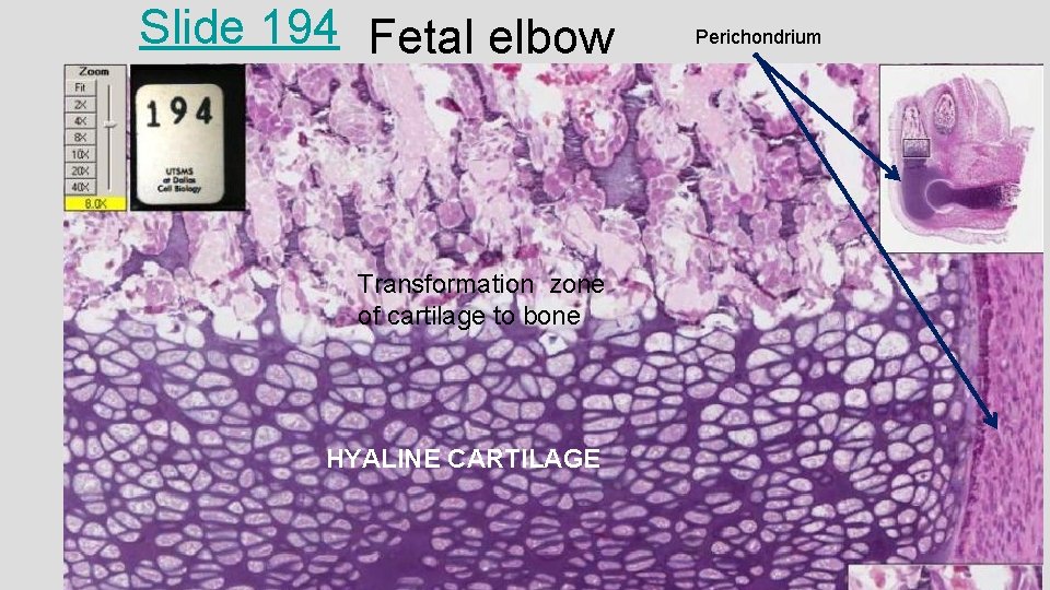 Slide 194 Fetal elbow Transformation zone of cartilage to bone HYALINE CARTILAGE Perichondrium 