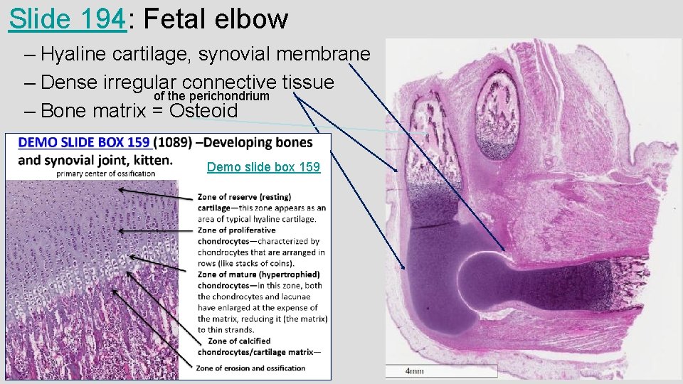 Slide 194: Fetal elbow – Hyaline cartilage, synovial membrane – Dense irregular connective tissue