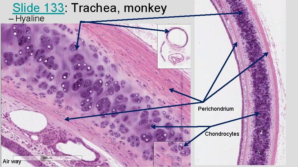 Slide 133: Trachea, monkey – Hyaline cartilage Perichondrium Chondrocytes Air way 
