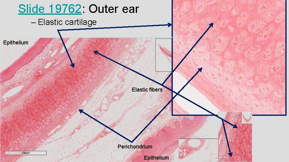 Slide 19762: Outer ear – Elastic cartilage Epithelium Elastic fibers Perichondrium Epithelium 