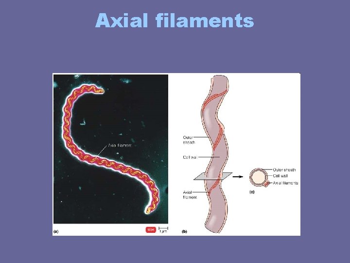 Axial filaments Axial filaments