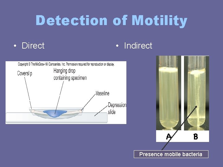 Detection of Motility • Direct • Indirect Presence mobile bacteria Detection of Motility • Direct • Indirect Presence mobile bacteria