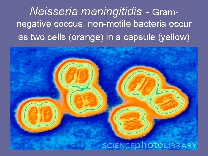 Neisseria meningitidis - Gramnegative coccus, non-motile bacteria occur as two cells (orange) in a Neisseria meningitidis - Gramnegative coccus, non-motile bacteria occur as two cells (orange) in a