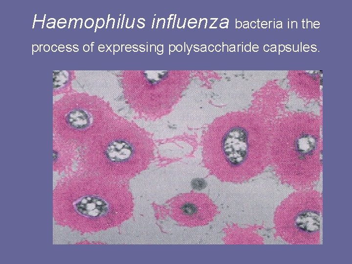 Haemophilus influenza bacteria in the process of expressing polysaccharide capsules. Haemophilus influenza bacteria in the process of expressing polysaccharide capsules.