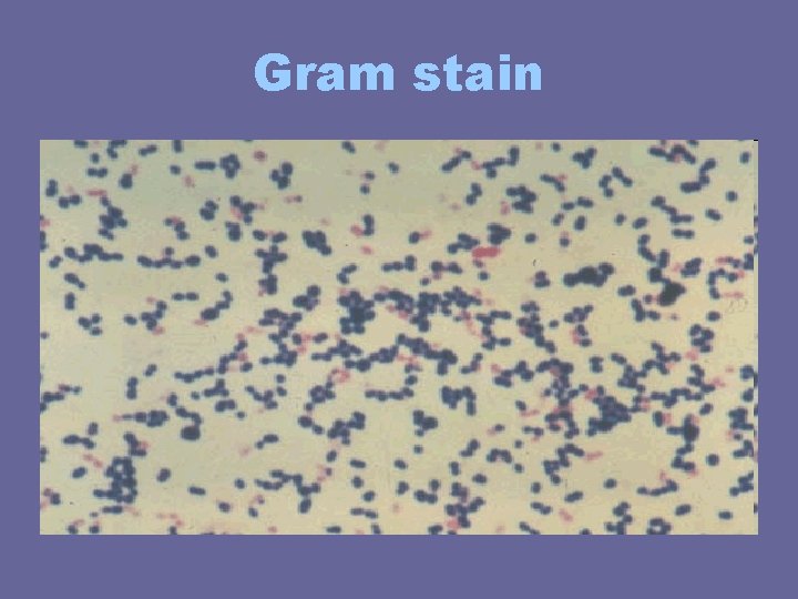 Gram stain Gram stain
