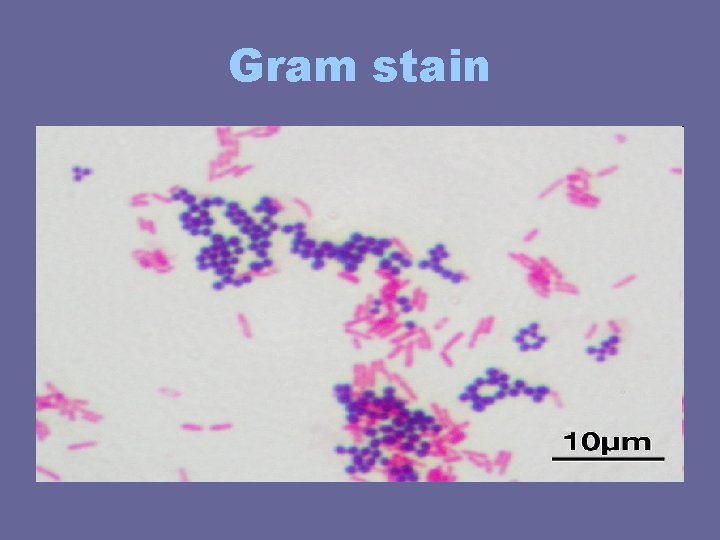 Gram stain Gram stain