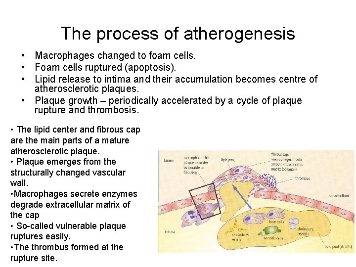 The process of atherogenesis • Macrophages changed to foam cells. • Foam cells ruptured