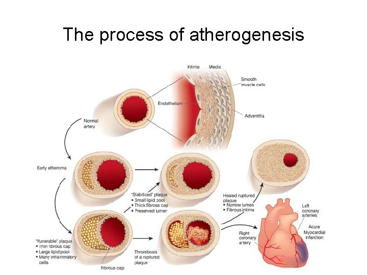 The process of atherogenesis 