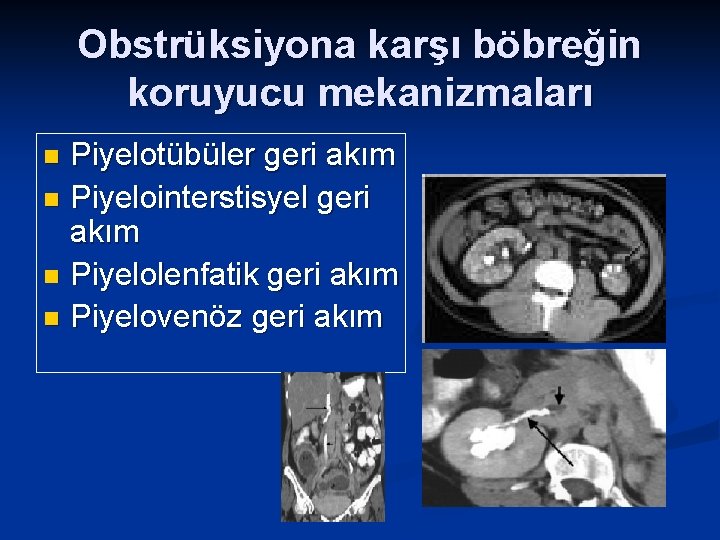 Obstrüksiyona karşı böbreğin koruyucu mekanizmaları Piyelotübüler geri akım n Piyelointerstisyel geri akım n Piyelolenfatik