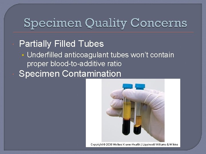 Partially Filled Tubes • Underfilled anticoagulant tubes won’t contain proper blood-to-additive ratio Specimen