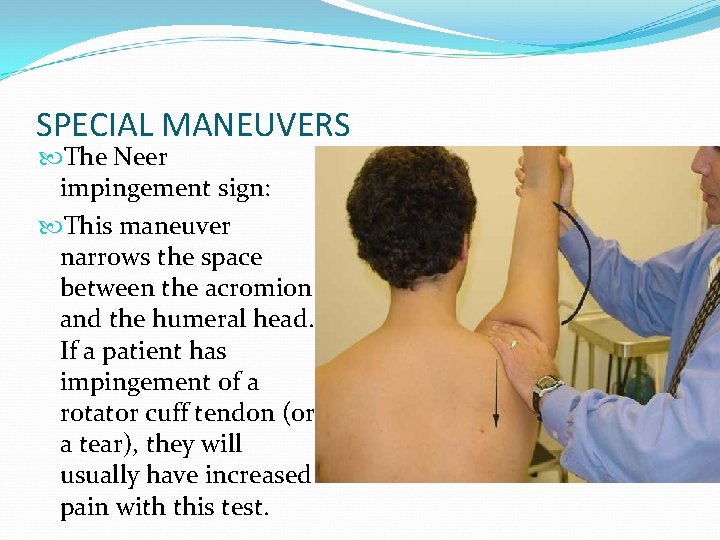 SPECIAL MANEUVERS The Neer impingement sign: This maneuver narrows the space between the acromion