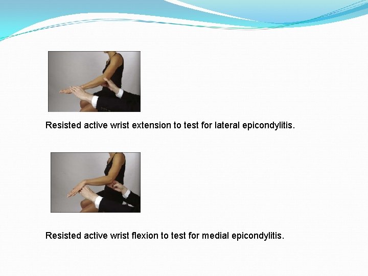Resisted active wrist extension to test for lateral epicondylitis. Resisted active wrist flexion to