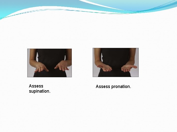 Assess supination. Assess pronation. 