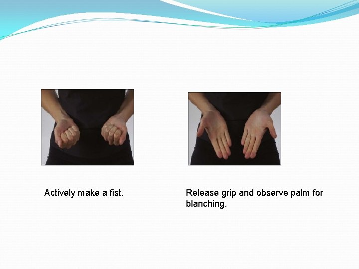 Actively make a fist. Release grip and observe palm for blanching. 