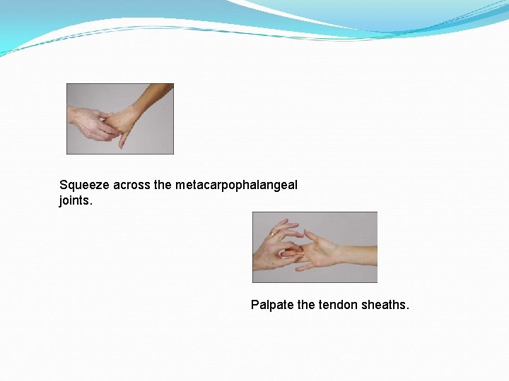 Squeeze across the metacarpophalangeal joints. Palpate the tendon sheaths. 